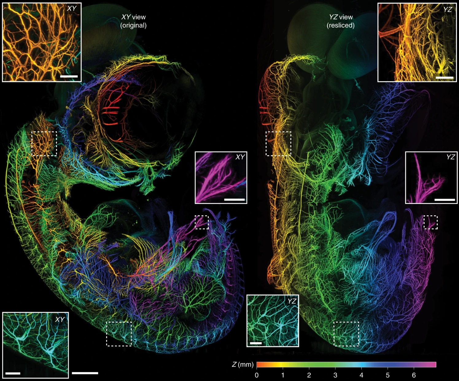 We collaborated on an opensource microscope. It could save researchers